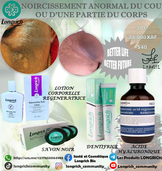 Noircissement Anormal d’une partie du corps Traitement Longrích